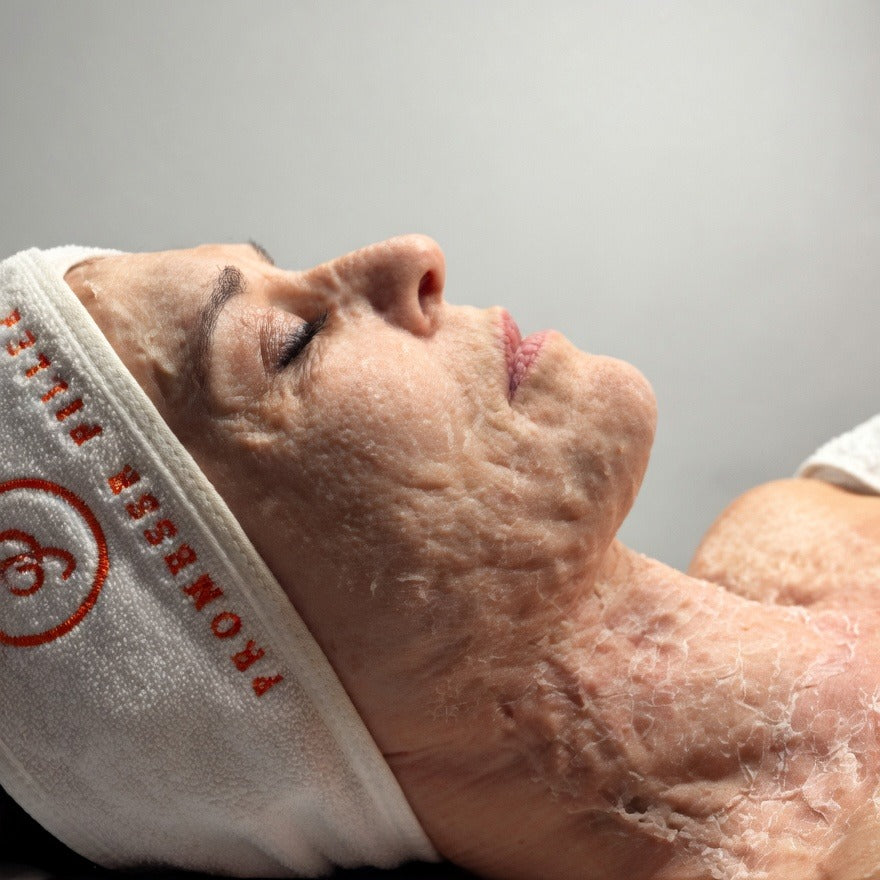 Masque en Poudre Effet Botox – Lifting Immédiat & Anti-Rides Intensif – Promesse Filler - Best seller