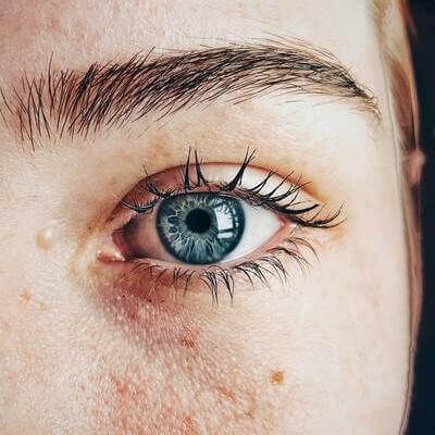 Cernes sous les yeux : comment les atténuer durablement en 2026 ? Le guide complet de la médecine esthétique Image