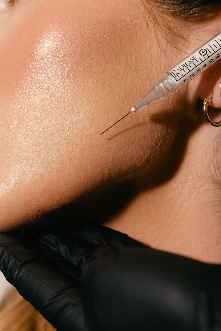 Injectable-Comblement Image