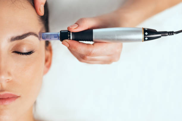 Mésothérapie/Microneedling Image