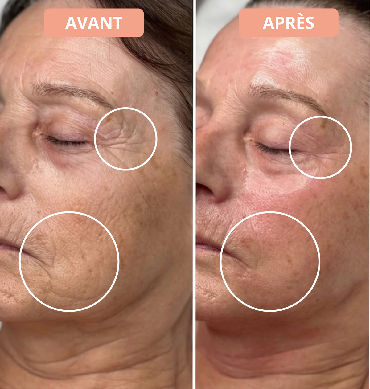 Les résultats du masque sont immédiat ! Avec des résultats visibles dès la première séance.
