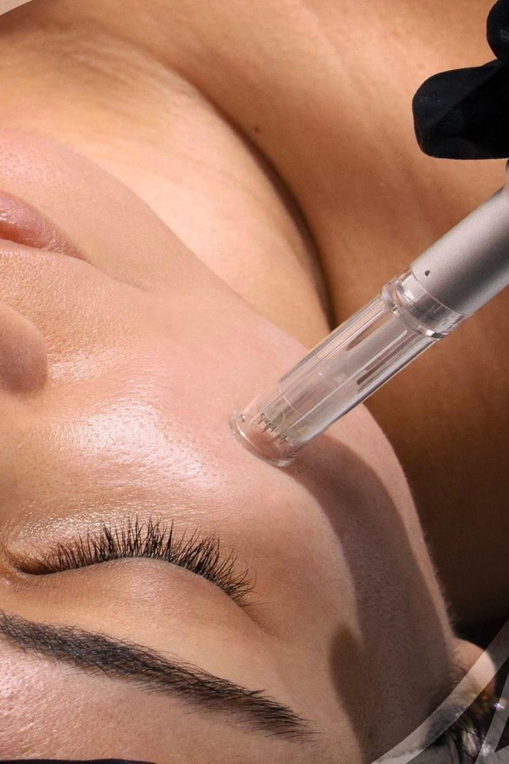 Formation Nano-needling