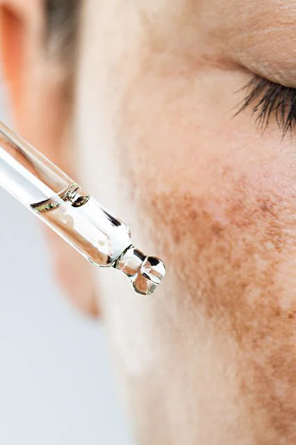 peeling, éclaircissement des taches, taches soleil, tache brunes, tache acné